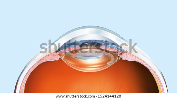 medically 3D illustration showing human\
eye with artificial lens, pupil, iris, anterior chamber, posterior\
chamber, ciliary body, eye ball and vitreous\
body