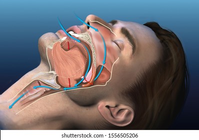 Medically 3D Illustration Showing A Sleeping Snoring Man