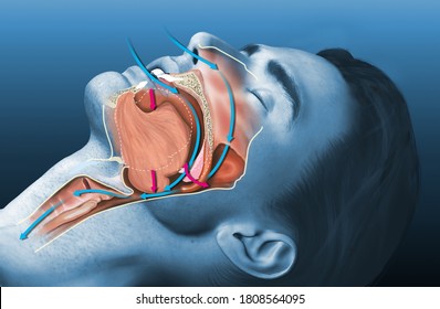 Medically 3D Illustration Shows A Sleeping Snoring Man