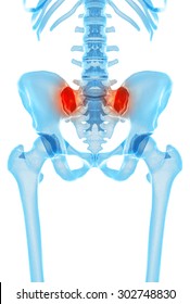 medically accurate illustration - painful sacroiliac joint