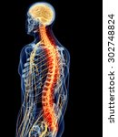 medically accurate illustration - painful spine