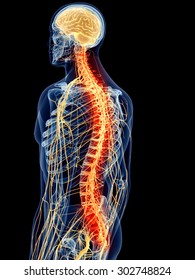medically accurate illustration - painful spine