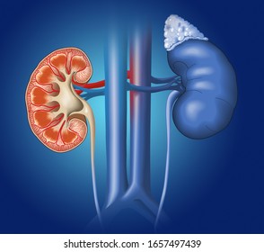 Medically Illustration Showing Cross-section Of A Kidney With With Inferior Vena Cava And Descending Aorta On Blue Background