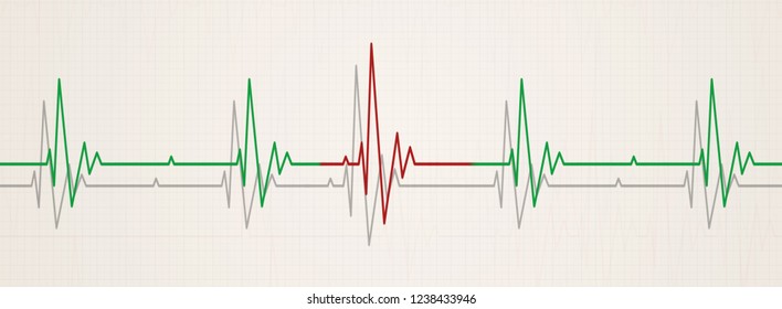 Medicine Banner Illustrating Irregular Heart Beat On Ecg During Monitor