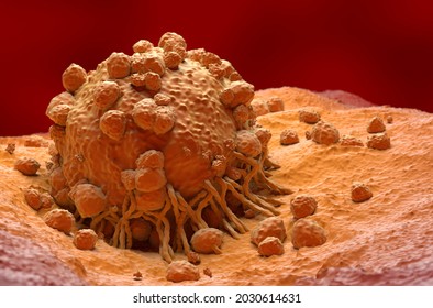 Melanoma Cell A Type Of Skin Cancer Closeup View 3d Illustration