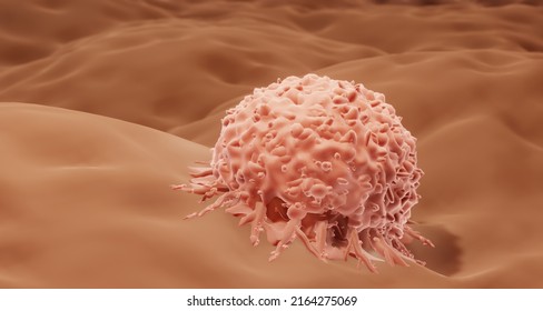 Melanoma, Skin Cancer Cell, 3d Illustration