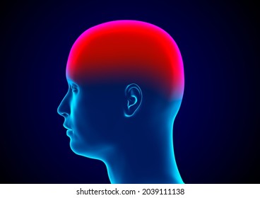 Meningitis is an inflammation of the meninges, the membranes that surround the brain and spinal cord. 3D rendering - Powered by Shutterstock