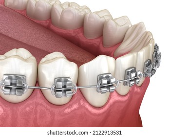 158 Misaligned jaw Images, Stock Photos & Vectors | Shutterstock