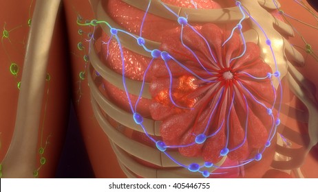 Metastasis Infection 3d Illustration