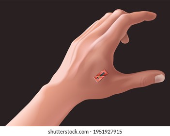 Micro Chips Under The Skin, Subcutaneous Chip. Illustration