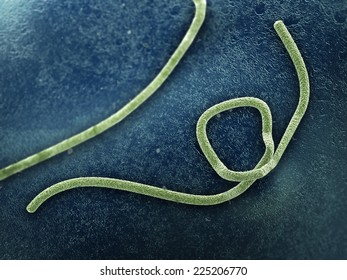 A microscope image of Ebola virus.