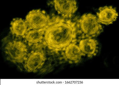 Microscope Image Shows The Coronavirus, SARS-CoV-2, Coronavirus 2019 (COVID 19) In Electron Microscope View Group Of Virus.