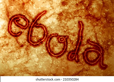 Microscopic view of Ebola Virus