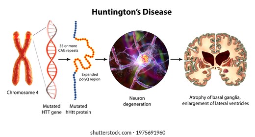 Molecular Genesis Huntingtons Disease 3d Illustration Stock ...