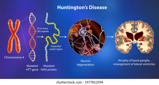 Molecular Genesis Huntingtons Disease 3d Illustration Stock ...