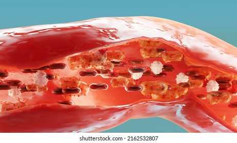 Monkeypox Infection Pandemic. Monkeypox Cell, Symptoms Or Precautions, Variant Of Smallpox, Mutated Fever Monkey, Virus Threat To Human Health, Blood Vessel, Cross Section, 3d Render