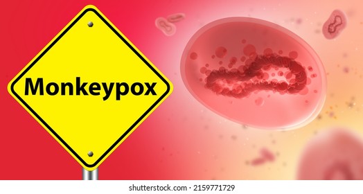 Monkeypox Warning. Molecules Of Dangerous Virus In Body. Monkeypox Warning Yellow Road Sign. Smallpox Viral Infection. Monkey Disease. Risk Of Contracting Fever Warning. Smallpox Outbreak. 3d Image.