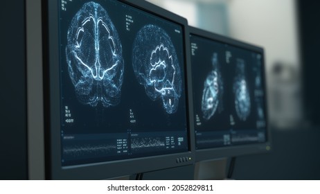 MRI Heart And Head Scanning. Brain Tumor, Cancer X-ray Diagnostics. Patient’s Vital Signs Displayed On Hospital Screens. Disease Diagnosis. CT Scan Human Ilness Research 3D Render Medical Illustration