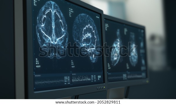 MRI heart and head scanning. Brain tumor,\
cancer X-ray diagnostics. Patient’s vital signs displayed on\
hospital screens. Disease diagnosis. CT scan Human ilness research\
3D Render Medical\
illustration