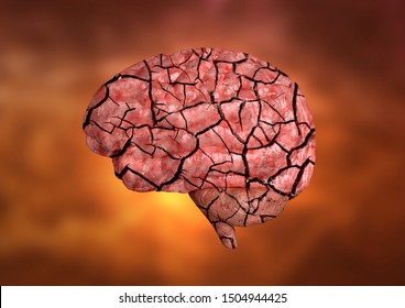 Multiple Sclerosis Is An Autoimmune Disease That Affects The Brain, Optic Nerves And Spinal Cord Affecting The Entire Central Nervous System. 3D Rendering