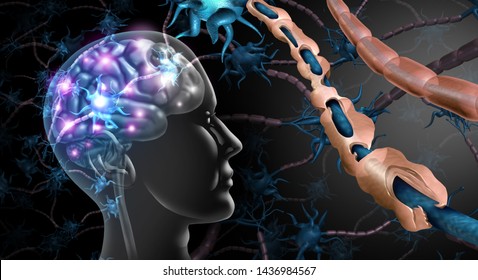 Multiple sclerosis nerve disorder and damaged myelin or MS autoimmune disease with healthy nerve with exposed fibre with scarred cell sheath loss with 3D illustration elements.