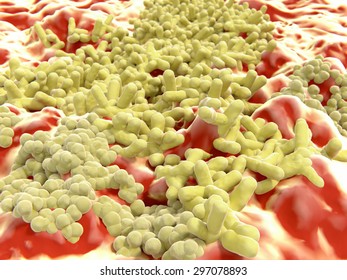 Multiresistant Bacteria, MRSA