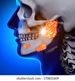 Mumps / Parotid Gland - Sickness