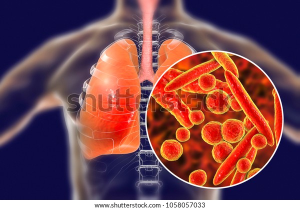 Mycoplasma Pneumoniae Bacteria Human Lungs 3d Stock Illustration 1058057033