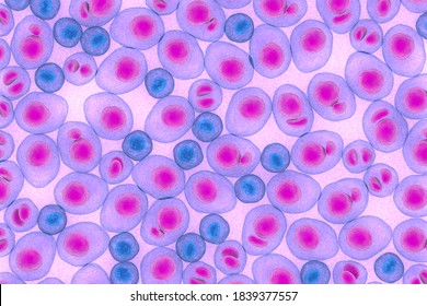 Myeloma multiplex leukemia cancer 3d color render illustration