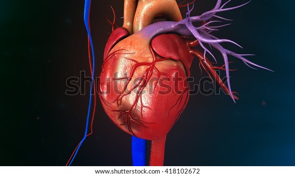 Myocardial Infarction 3d Illustration Stock Illustration 418102672