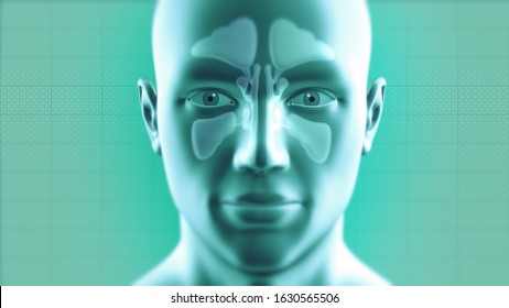 Nasal Sinus Infection Cured By Medicine. Frontal, Ethmoidal, Sphenoidal And Maxillary Sinuses. Sinusitis. 3D Illustration.