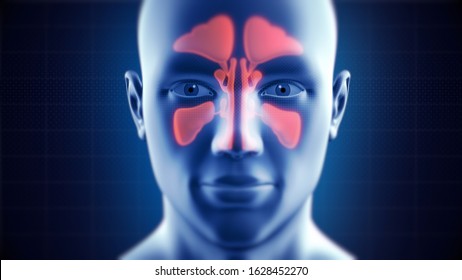 Nasal Sinus Infection. Frontal, Ethmoidal, Sphenoidal and Maxillary Sinuses. Sinusitis. 3D Illustration.