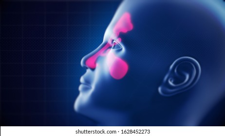 Nasal Sinus Infection. Frontal, Ethmoidal, Sphenoidal And Maxillary Sinuses. Sinusitis. 3D Illustration.