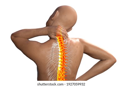 Neck Pain, 3D Conceptual Illustration