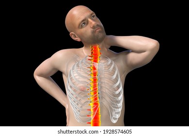 Neck pain, 3D conceptual illustration