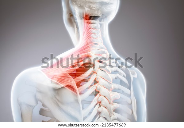 Neck pain, cervical vertebrae spine, human\
body anatomy, 3d\
illustration\
