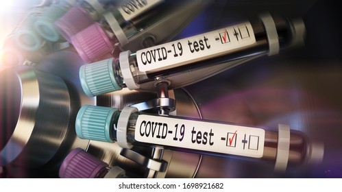 Negative COVID-19 test and laboratory sample of blood testing for diagnosis new Corona virus infection (novel corona virus disease 2019) from Wuhan. Pandemic infectious concept 3D rendering