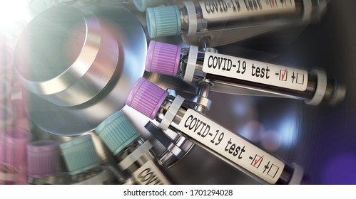 Negative COVID-19 Test And Laboratory Sample Of Blood Testing For Diagnosis New Corona Virus Infection (novel Corona Virus Disease 2019). Pandemic Infectious Concept 3D Rendering