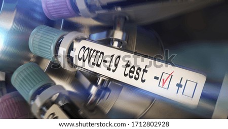Negative COVID-19 test and laboratory sample of blood testing for diagnosis new Corona virus infection (novel corona virus disease 2019) from Wuhan. Pandemic infectious concept 3D rendering