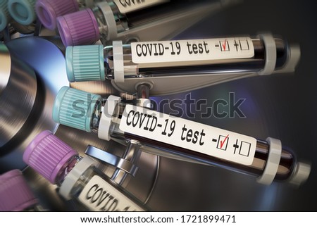 Negative COVID-19 test and laboratory sample of blood testing for diagnosis new Corona virus infection (novel corona virus disease 2019). Pandemic infectious concept 3D rendering