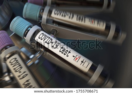 Negative COVID-19 test and laboratory sample of blood testing for diagnosis new Corona virus infection (novel corona virus disease 2019) from Wuhan. Pandemic infectious concept 3D rendering