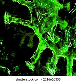 Neon Infection Cell. Green Cancer T Cells. Mint Microscopic Cells. Cancer Virus. Black Coronavirus. Antibodies Attacking Cancer. Cancer Cell Receptor. Funny Bacteria.