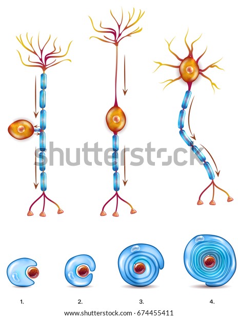 神経細胞型とミエリン鞘形成期 シュワン細胞が ミエリン鞘を形成する軸索を包囲し回転し 軸索が有髄になる 詳細な解剖図の接写 のイラスト素材