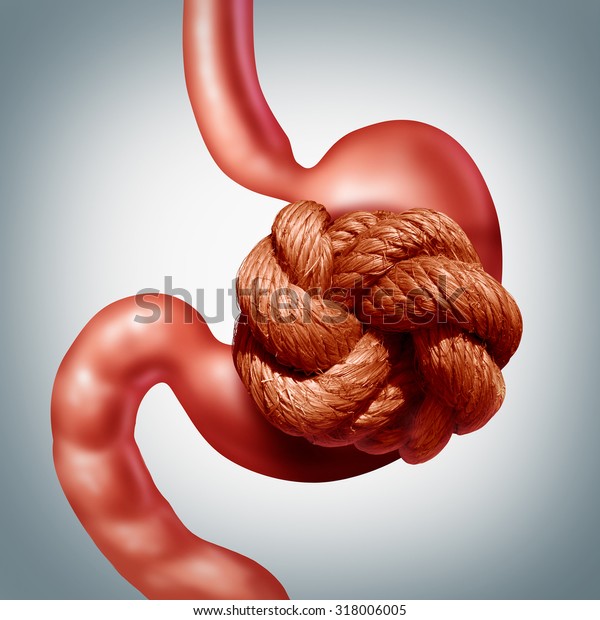 Nervous stomach problem and pain or stomachache
and ulcer discomfort concept as a human digestive organ painfully
wrapped with a tight rope knot as a medical healthcare stress and
anxiety symbol.
