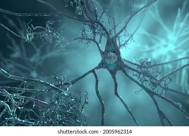 Neurons In Alzheimer's Disease. 3D Illustration Showing Amyloid Plaques In Brain Tissue, Neurofibrillary Tangles And Distruction Of Neuronal Networks