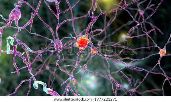 Neurons of Dorsal striatum, 3D illustration. The\
dorsal striatum is a nucleus in the basal ganglia, degrading of its\
neurons plays a crucial role in the development of Huntington\'s\
disease
