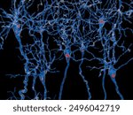 Neurons with Lewy bodies. Lewy bodies develop inside nerve cells in Parkinson