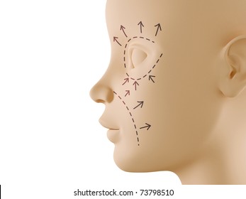 Neutral Face Profile With Aesthetic Surgery Sign