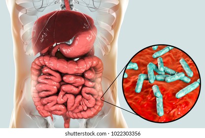 Norovirus Human Intestine Called Winter Vomiting Stock Illustration ...