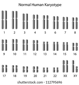 Normal Human Karyotype